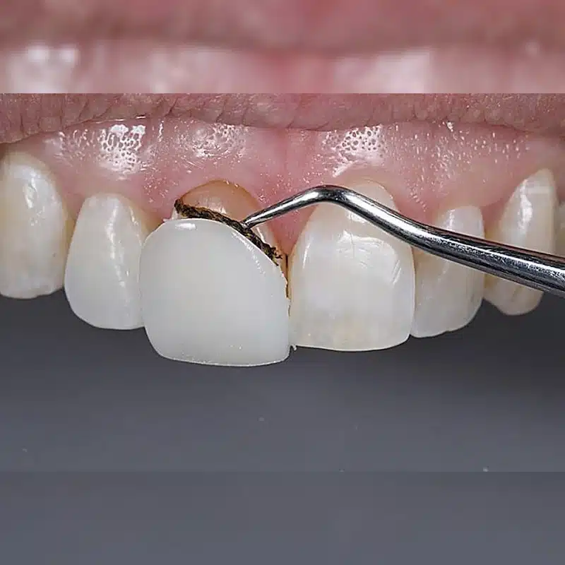 2e36acda f60a 4e7a 8552 b078143bad41