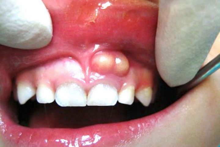 d7608638 153b 432b acfd 8d01290286bf